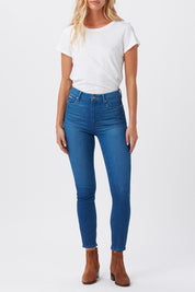 MARGOT ANKLE  AMIA
